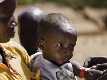 África mantiene grandes índices de mortalidad infantil África mantiene grandes índices de mortalidad infantil
