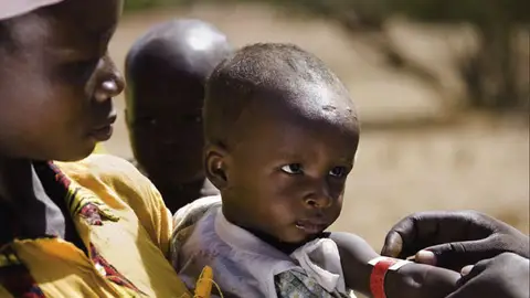 África mantiene grandes índices de mortalidad infantil África mantiene grandes índices de mortalidad infantil