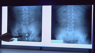 Cae una red que utilizaba a mujeres embarazadas para el tráfico de cocaína