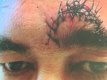 Un hostelero, agredido por un fumador Un hostelero, agredido por un fumador