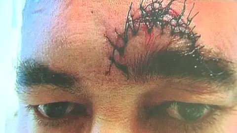 Un hostelero, agredido por un fumador Un hostelero, agredido por un fumador