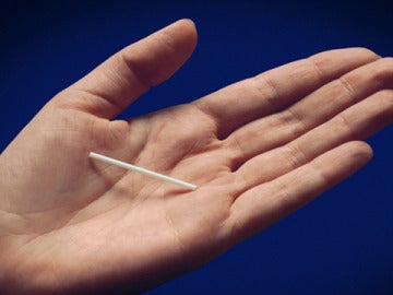 'Implanon', el implante anticonceptivo