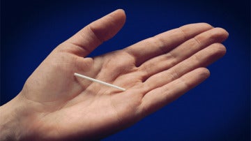 'Implanon', el implante anticonceptivo