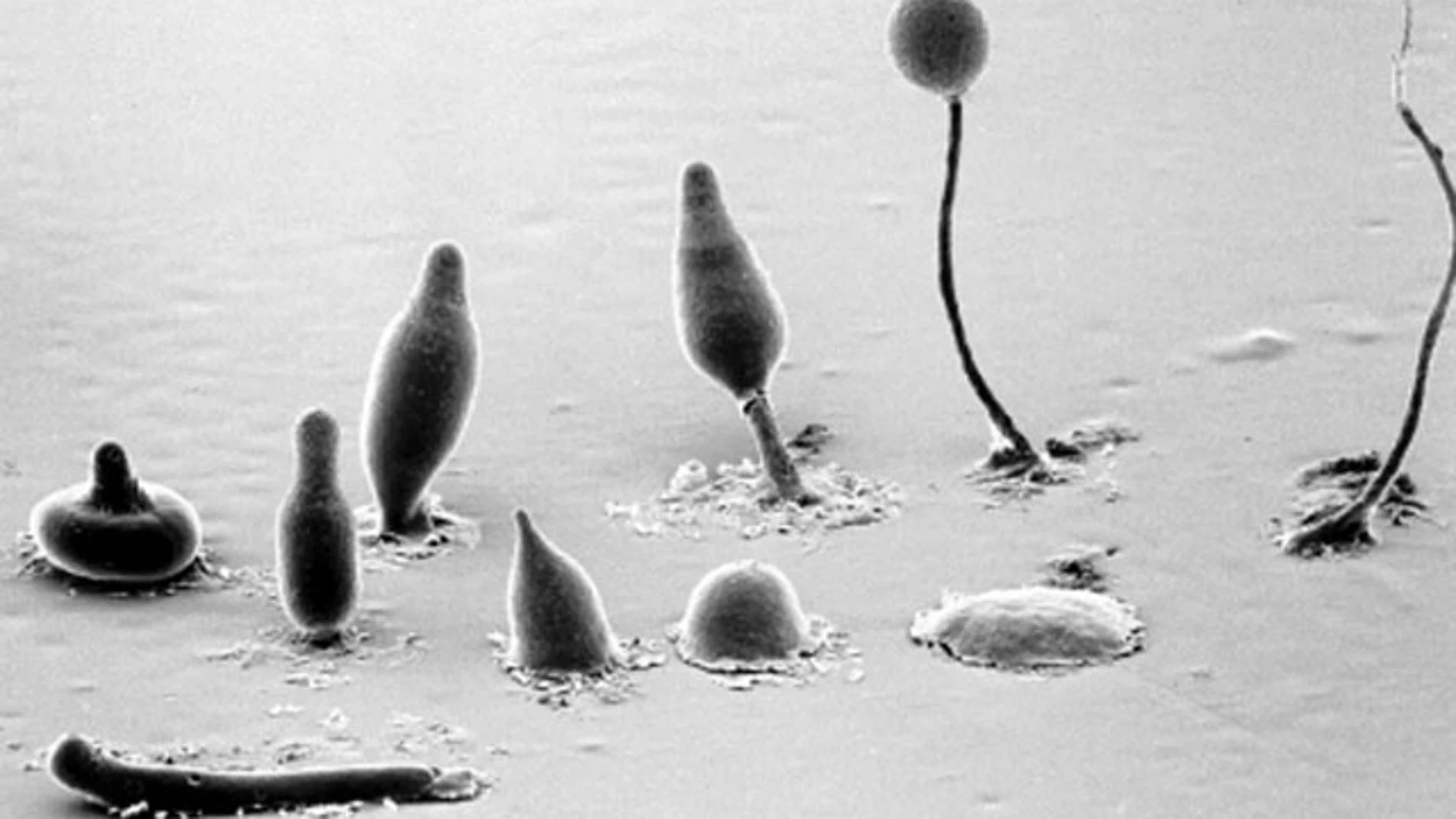 Descubren una especie de ameba que practica la agricultura Descubren una especie de ameba que practica la agricultura