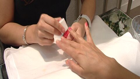 Muy grave tras estallarle el bote de acetona de las u&ntilde;as mientras fumaba