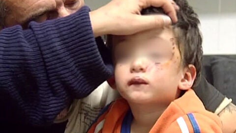 El peque&ntilde;o herido por el perro