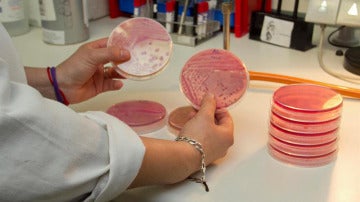 Análisis de laboratorio de la bacteria E.Coli