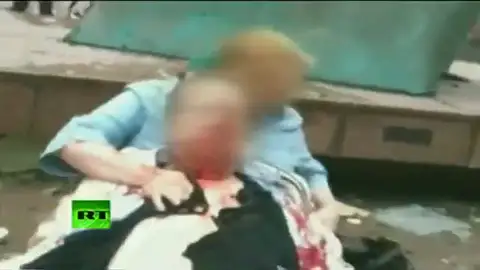 Heridos en el atentado de Oslo Heridos en el atentado de Oslo