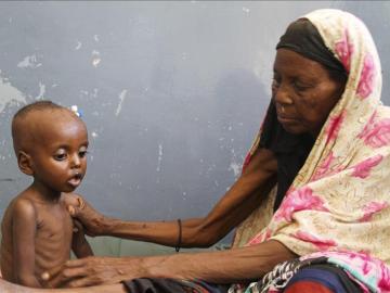 Una mujer somalí cuidad de su hijo de un año de edad en una clínica de Mogadiscio