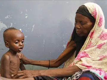 Una mujer somalí cuidad de su hijo de un año de edad en una clínica de Mogadiscio Una mujer somalí cuidad de su hijo de un año de edad en una clínica de Mogadiscio