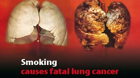 Cartel que advierte de los riesgos de fumar