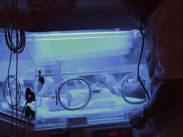 Una enfermera contagia de tuberculosis a 96 bebés en un hospital italiano Una enfermera contagia de tuberculosis a 96 bebés en un hospital italiano