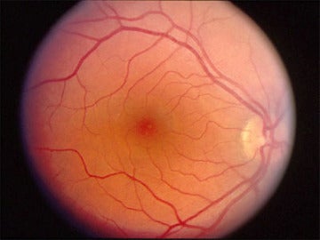 Imagen de la retina
