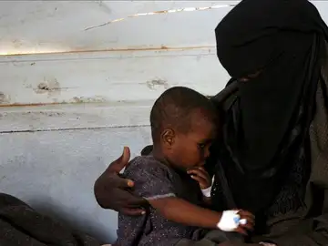 La OMS y UNICEF advierten del peligro de un brote de malaria en Somalia La OMS y UNICEF advierten del peligro de un brote de malaria en Somalia