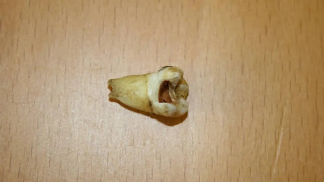 La muela de John Lennon