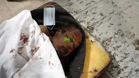 Imagen del cadáver de Gadafi Imagen del cadáver de Gadafi