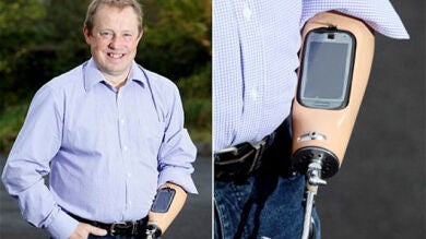 Si no tienes brazo... ¿cómo utilizar un smartphone? 