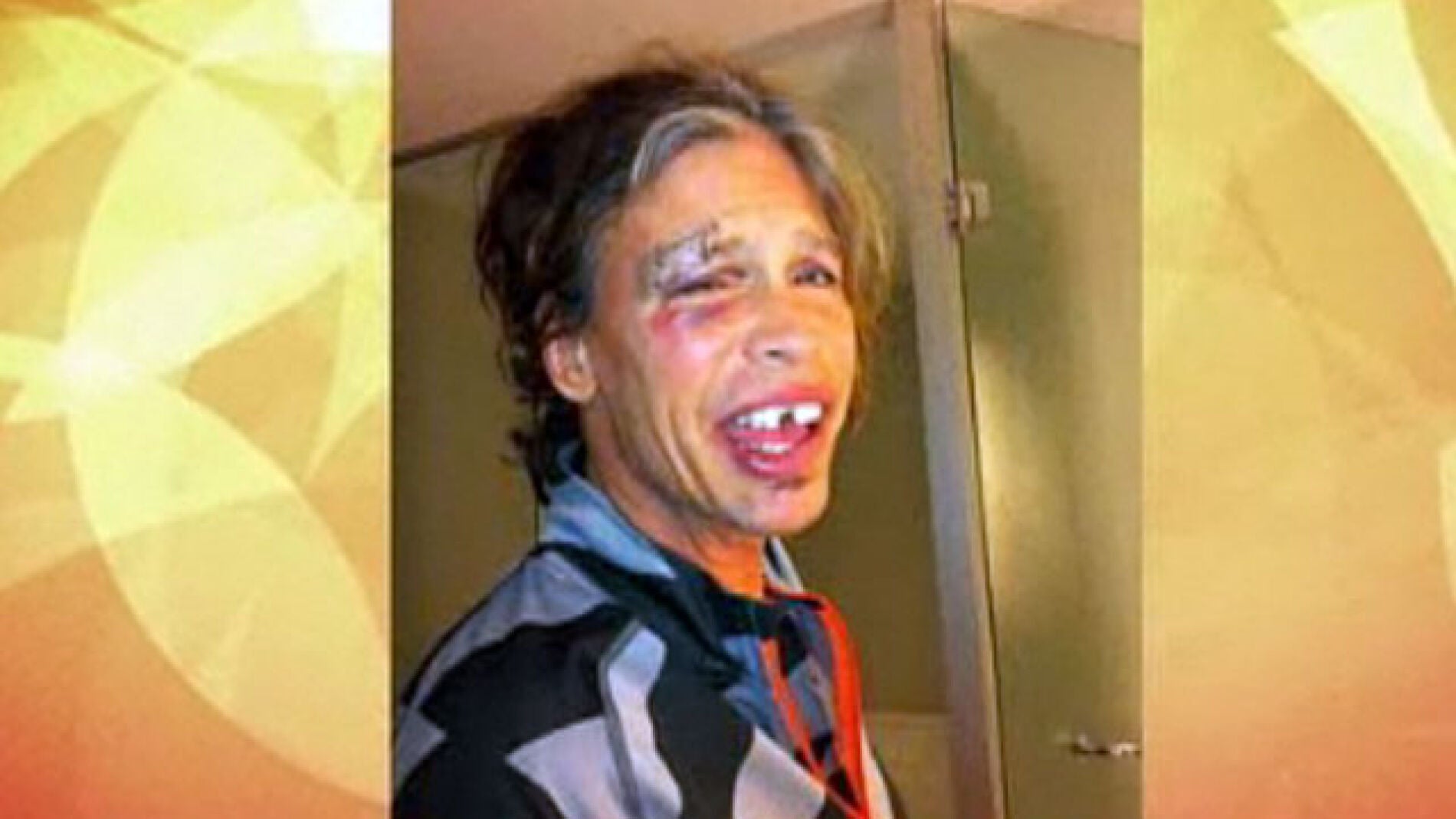 As&iacute; se le qued&oacute; la cara a Steven Tyler