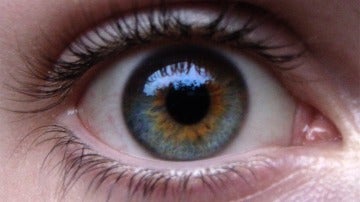 Ojos azules con manchas de marrón