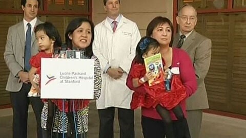 Las siamesas filipinas ya separadas