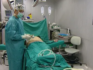 Operación de Lipo Fill-in Operación de Lipo Fill-in