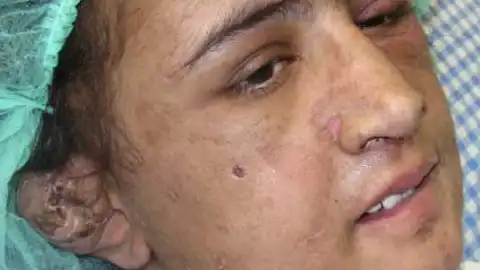Joven maltratada en Afganistán Joven maltratada en Afganistán