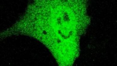 Científicos encuentran una cara feliz al mirar un cáncer al microscopio