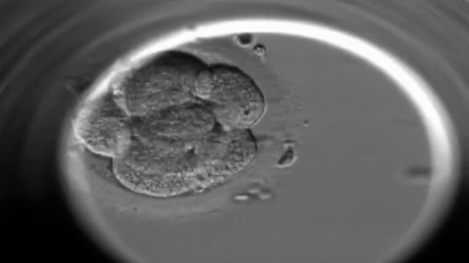 Los avances de la fecundación in vitro