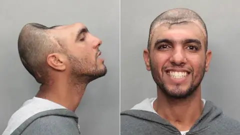Un hombre sobrevive con solo media cabeza Un hombre sobrevive con solo media cabeza