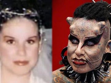 La 'mujer vampiro', antes y después