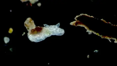 Microbios aumentados Microbios aumentados