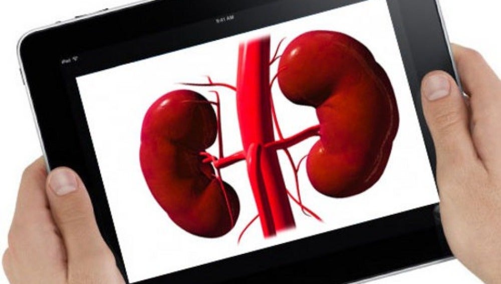 Tener en iPad puede legar a límites insospechados.