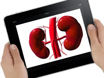 Tener en iPad puede legar a límites insospechados. Tener en iPad puede legar a límites insospechados.