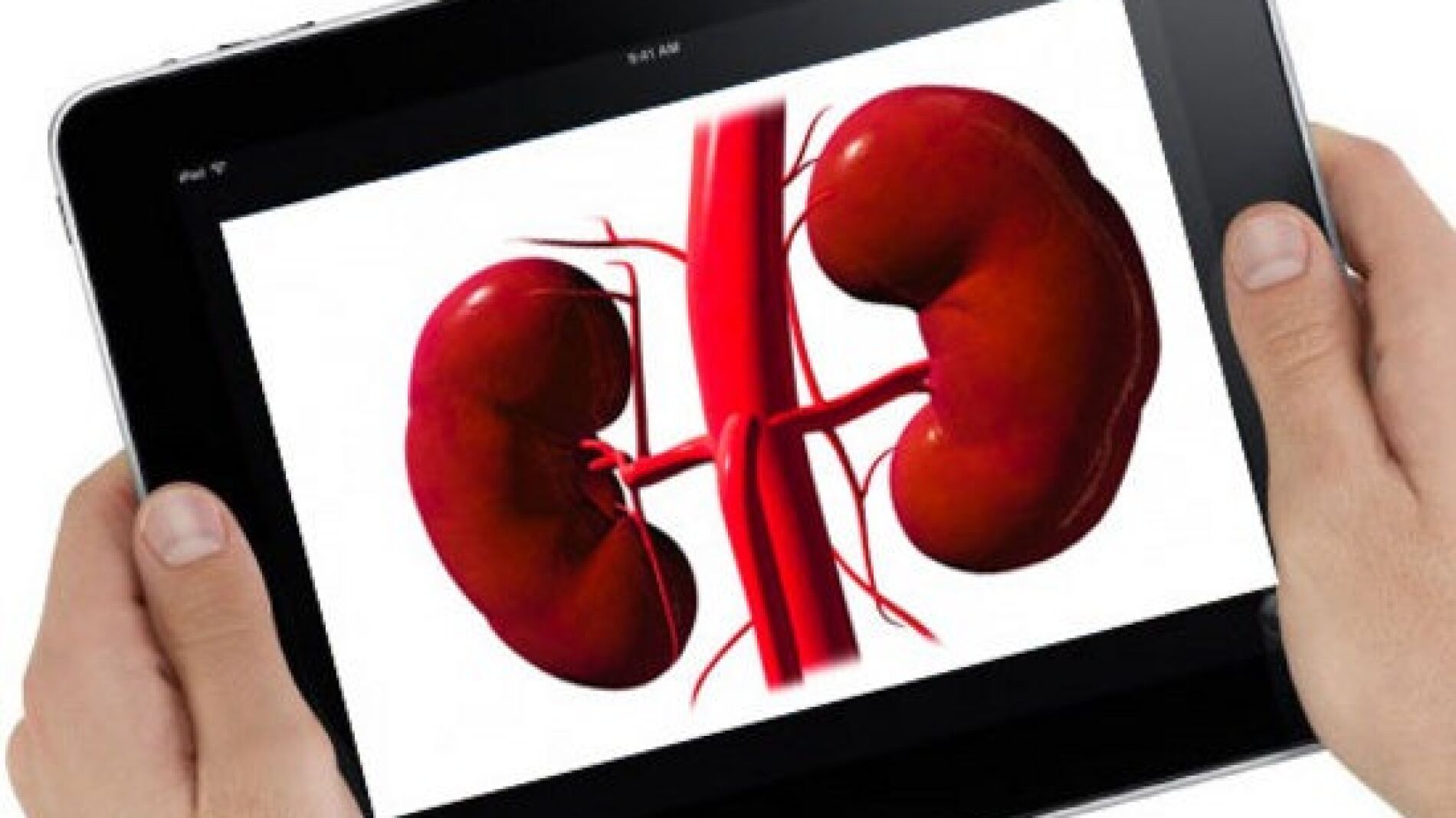 Tener en iPad puede legar a l&iacute;mites insospechados.