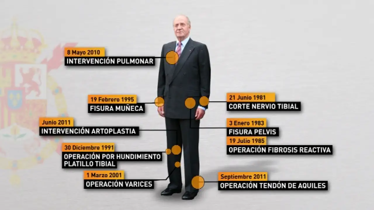 Diez intervenciones en 30 años