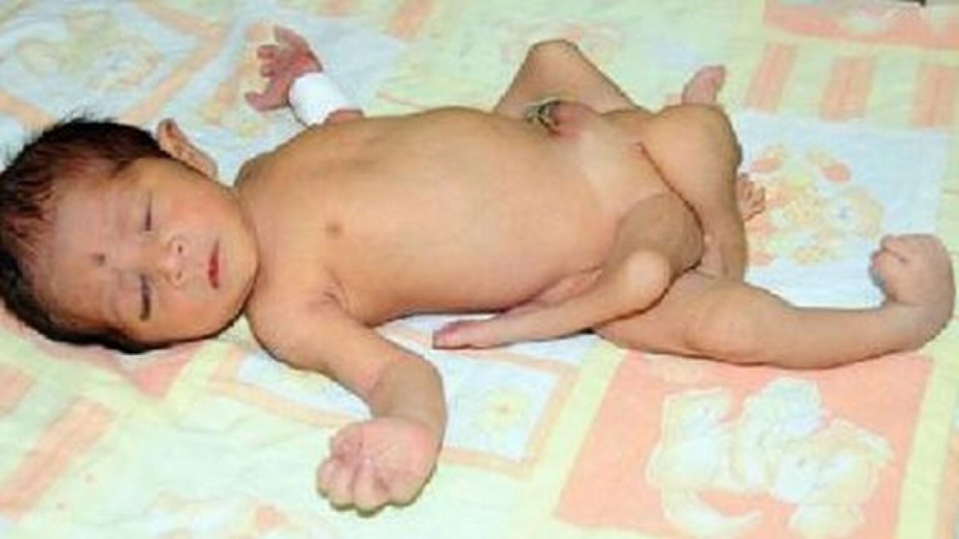 El peque&ntilde;o de las seis piernas
