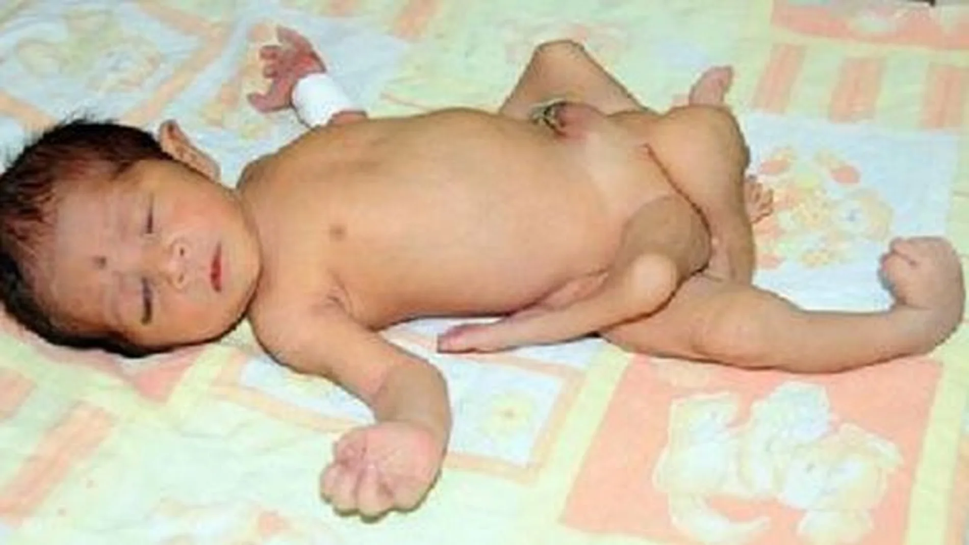 El pequeño de las seis piernas El pequeño de las seis piernas