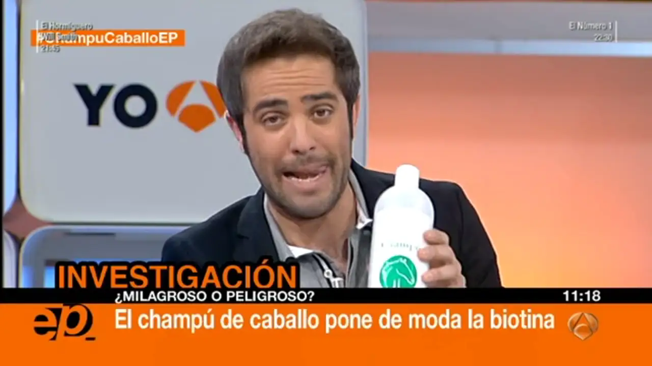 El pelo del caballo y el hombre son muy distintos