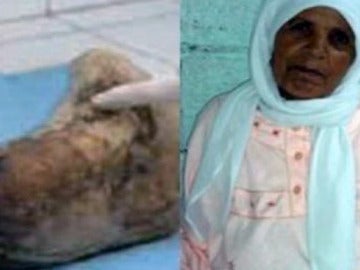 Zahra tuvo un bebé de piedra