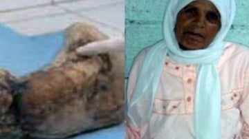 Zahra tuvo un bebé de piedra