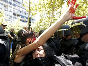 Mano manchada de sangre en la protesta minera Mano manchada de sangre en la protesta minera