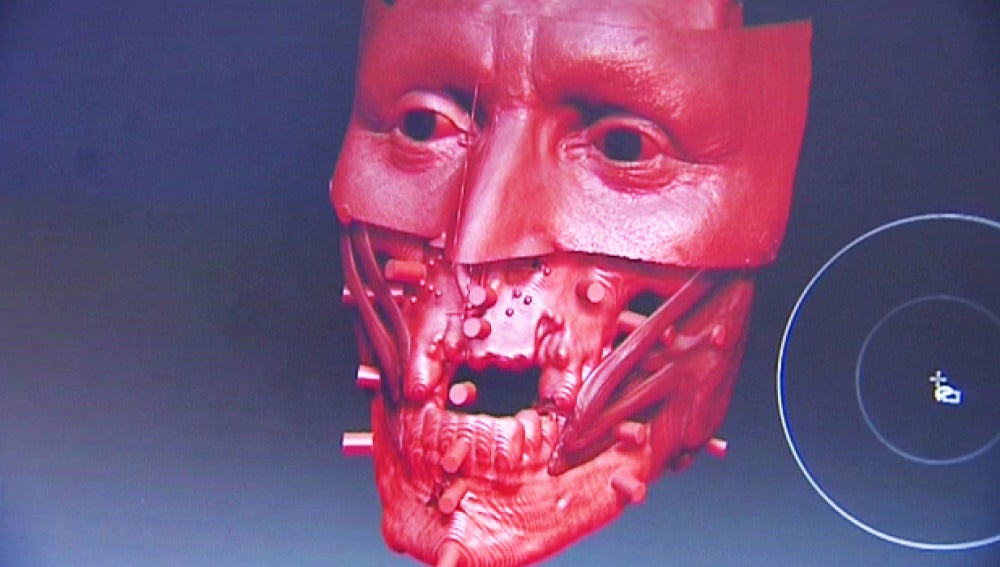 reconstrucción facial