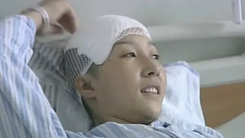 Le sacaron una aguja de la cabeza Le sacaron una aguja de la cabeza