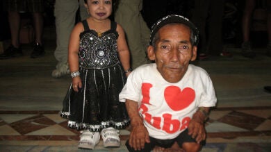 El hombre y la mujer más pequeños del mundo se citan en Katmandú