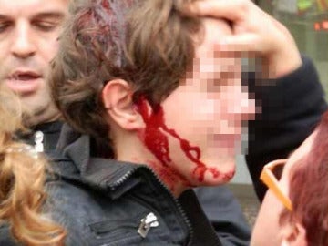 Un menor herido durante la huelga en Cataluña Un menor herido durante la huelga en Cataluña