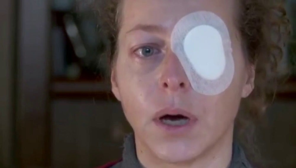 Esther Quintana cuenta cómo perdió un ojo