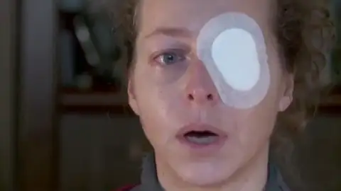 Esther Quintana cuenta cómo perdió un ojo Esther Quintana cuenta cómo perdió un ojo