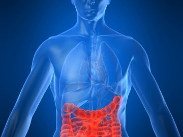 Consiguen frenar la metástasis del cáncer de colon