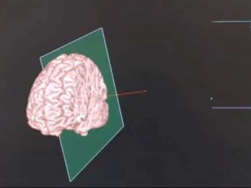 00057 00057