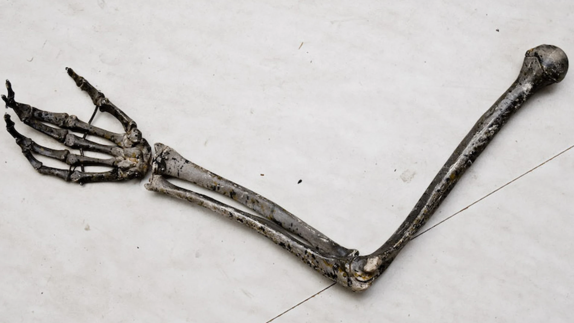 Huesos de un brazo Huesos de un brazo